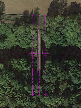 Zone prémol 2